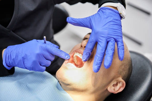 Best Emergency Dental Care for Sports Injuries in Haskell, TX